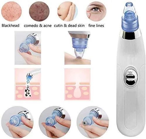 Blackhead Remover Derma suction Pore Vacuum Electric Pimple Extractor Skin Care Facial Pore Minimize Cleaning Tool